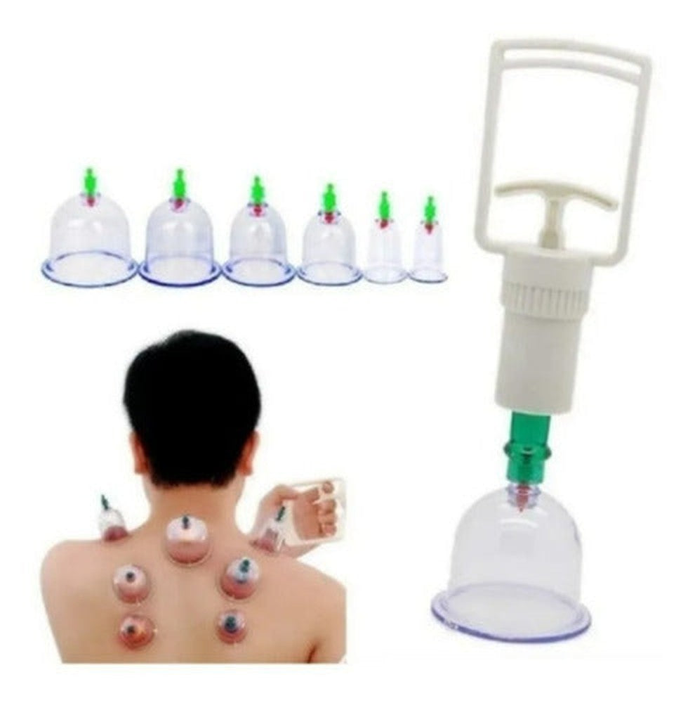 Ventosas Tecnica China Elimina Dolores, Celulitis 6 Copas